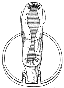Crimps at toe and heel Crimps at toe and heel
