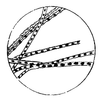Threads of Bacillus
Anthracis, Showing Spores
