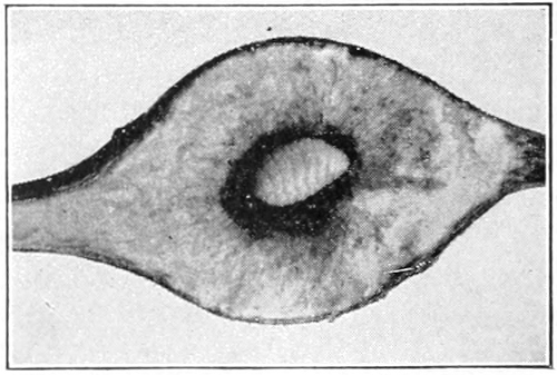 Spherical gall